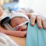 prematurni-bebinja (11)