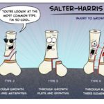 Salter-Harris-Fractures