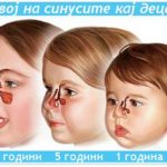 sinusi (11)