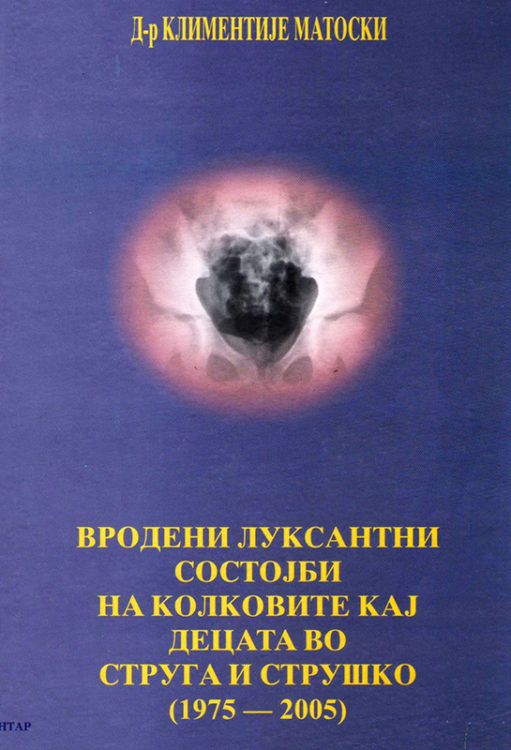 Вродени Луксантни Состојби на Колковите кај Децата во Струга и Струшко (1975-2005)