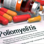 poliomyelitis