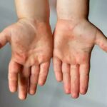 domaten-grip-vs-majmunski-sipanici (11)