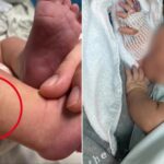 meningokokna-infekcija (1)