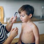 ПЕДИЈАТРИТЕ УКАЖУВААТ: Првите симптоми на овчи сипаници често поминуваат незабележани