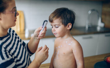 ПЕДИЈАТРИТЕ УКАЖУВААТ: Првите симптоми на овчи сипаници често поминуваат незабележани