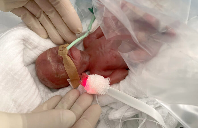 predvremeno-rodeno (1)