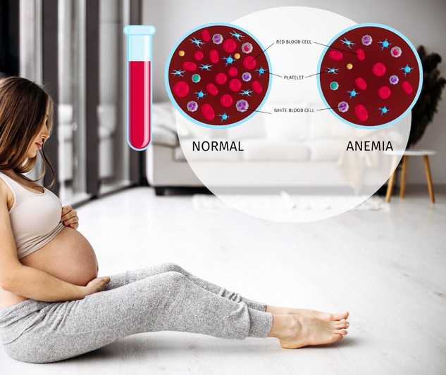 anemija-bremenost (2)