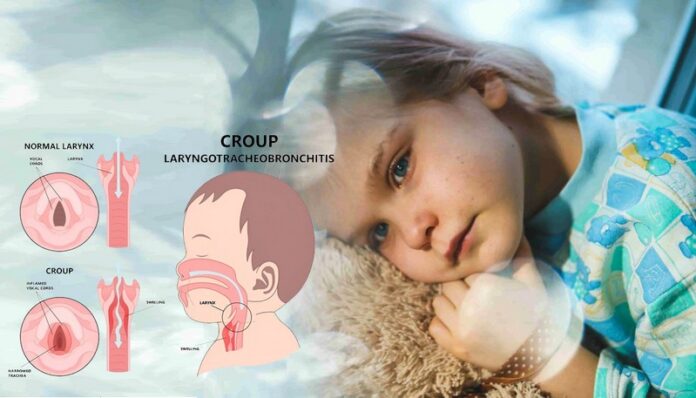 krup (2)